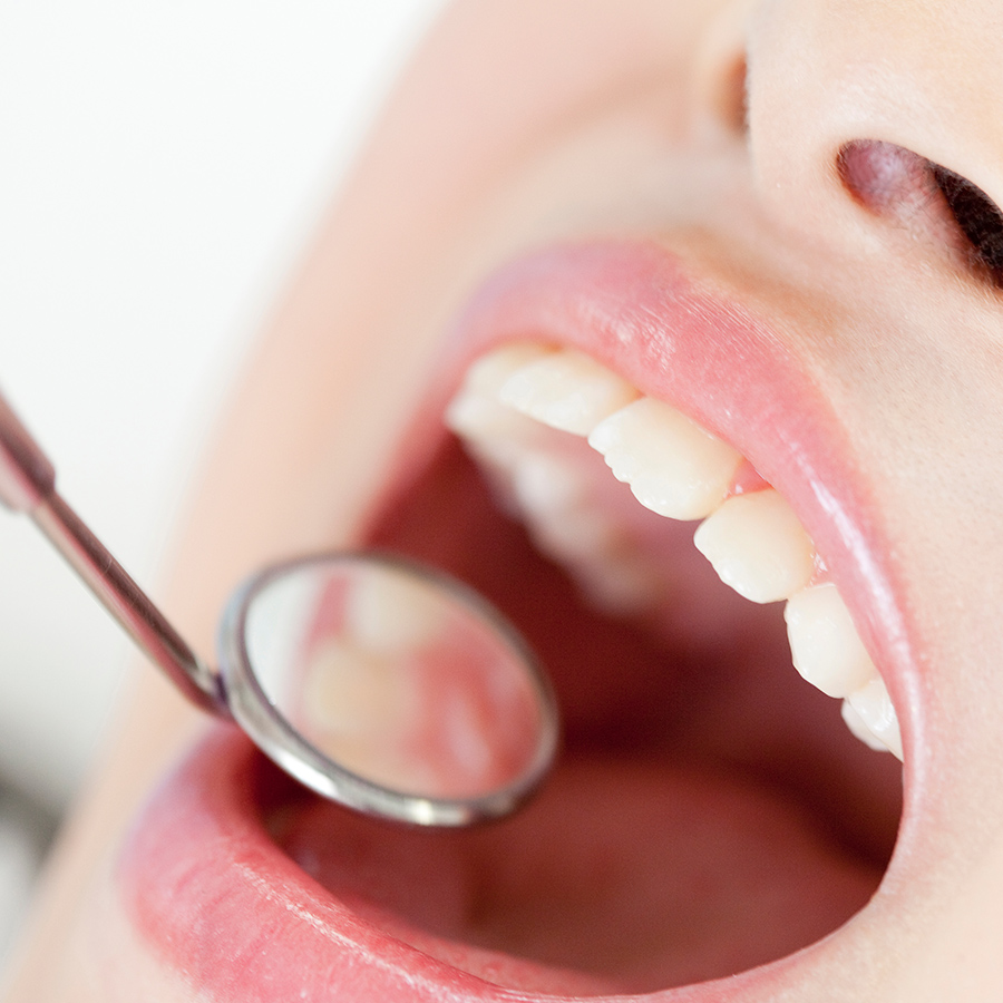 一般歯科（虫歯・歯周病治療）