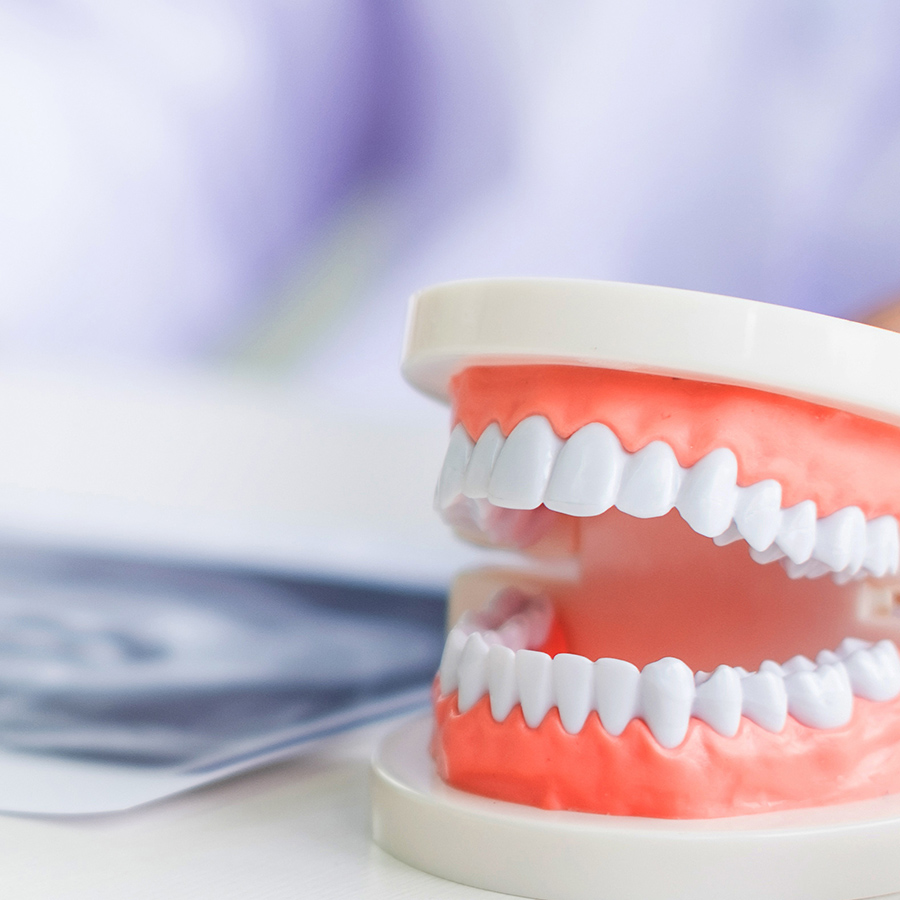 予防歯科（定期クリーニング・フッ素塗布）