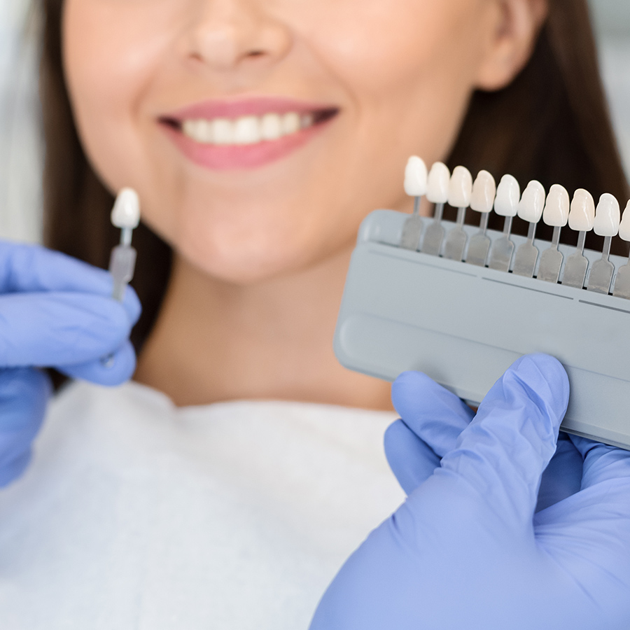 審美歯科（ホワイトニング・セラミック）